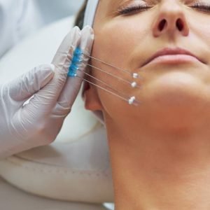 მეზოძაფები